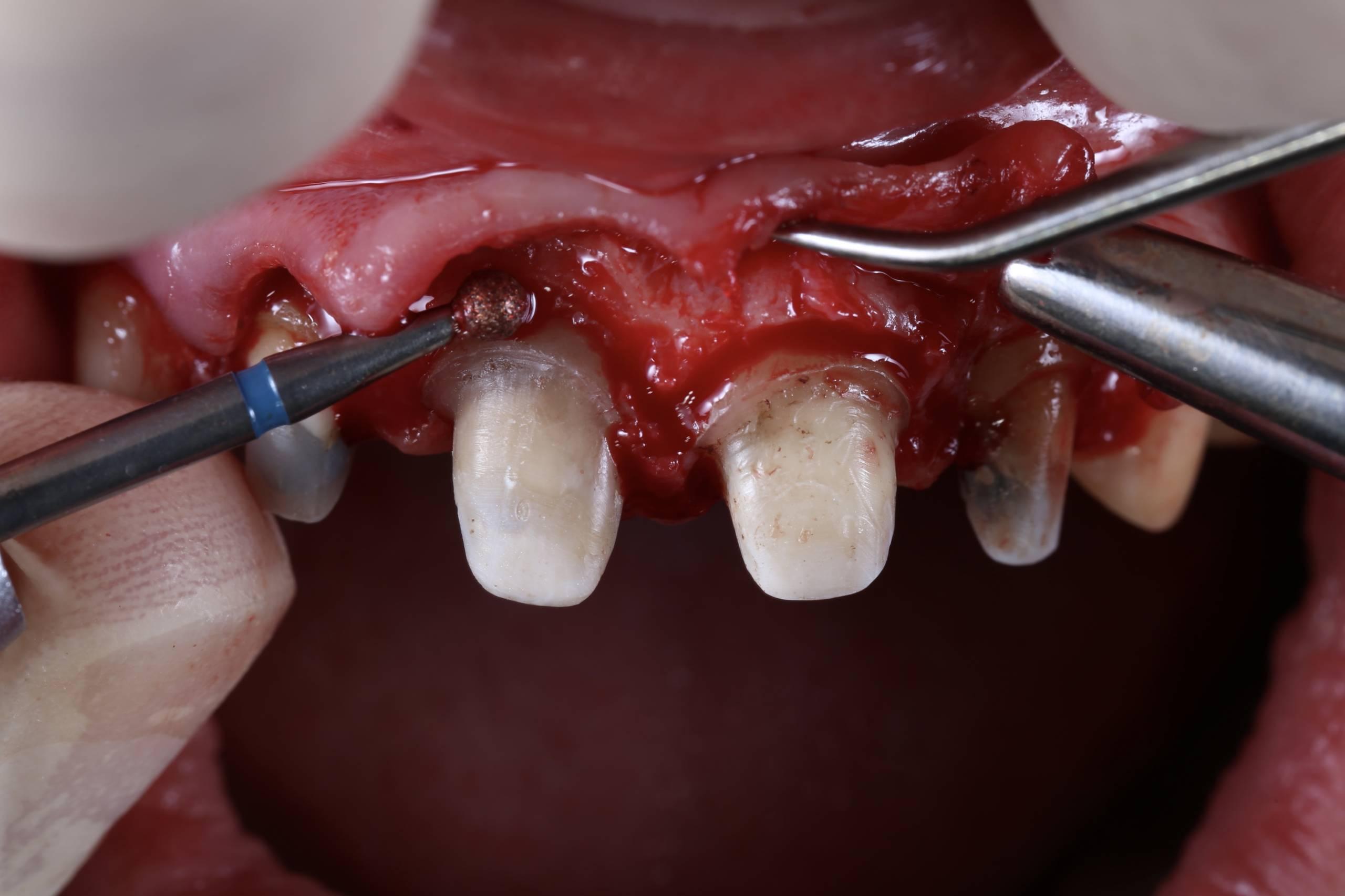 B-Kurs Red Aesthetics