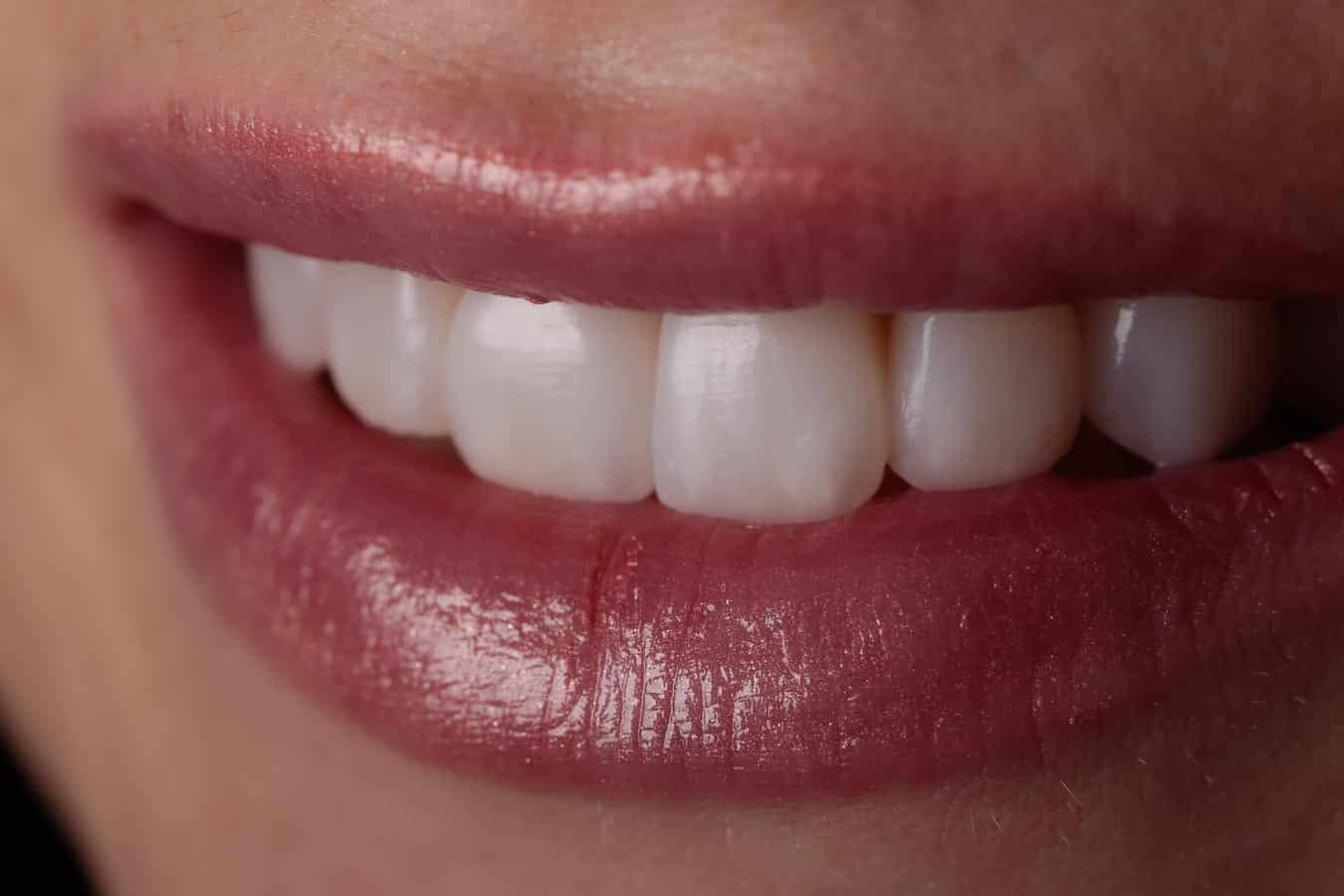 ästhetische zahnmedizin